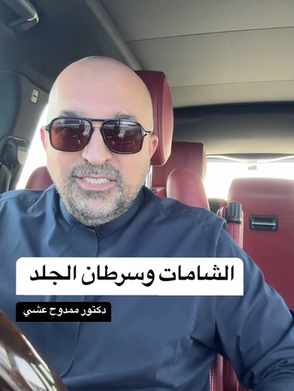 الشامات وسرطان الجلد !
