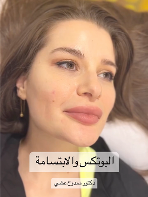 البوتوكس والإبتسامة ؟