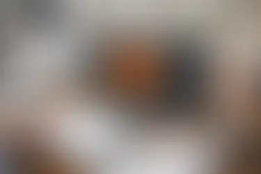 How to Find the CPT Code for Retinal Imaging