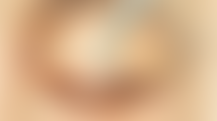 Eye Surgery Recovery: A Step-by-Step Guide to Healing Quickly