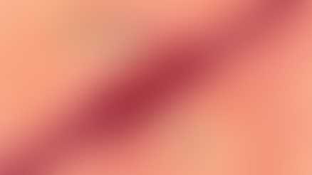 Retinal Vein Occlusion Causes: What Triggers This Vision Threat