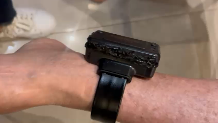 Bolsonaro diz que queimou tornozeleira com ferro de solda “por curiosidade” • Reprodução