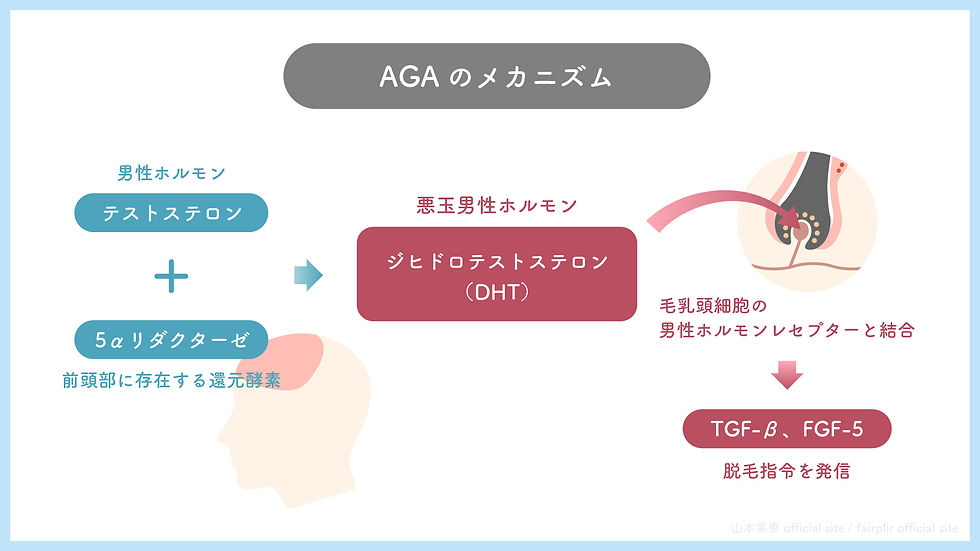 AGAのメカニズム