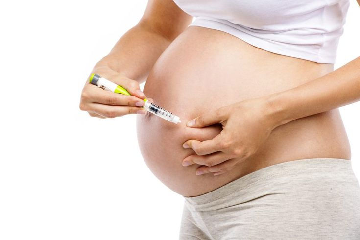 Myth Busting on Pregnancy and Type 1 Diabetes.jpg
