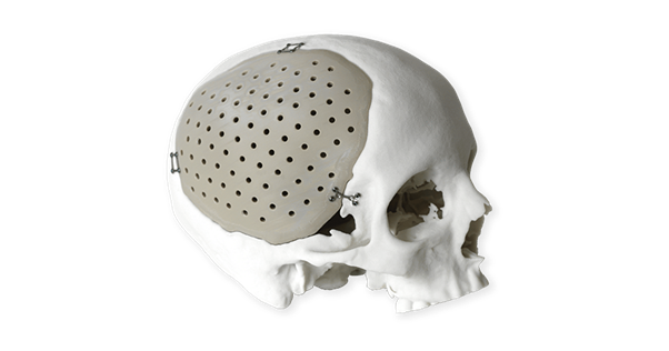 2fe153_93ca23db87fc4a1b9ecb91503dff8e53~mv2 (1).png