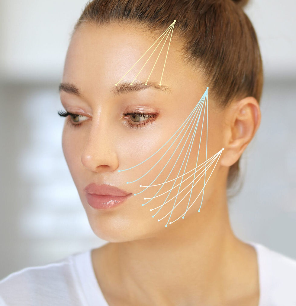 Thread-Lift-markup-thread-lift-procedure-for-facial-rejuvenation-1481x1536.jpg