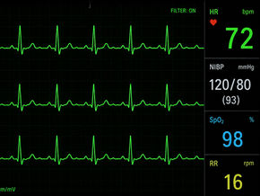Ekg scan