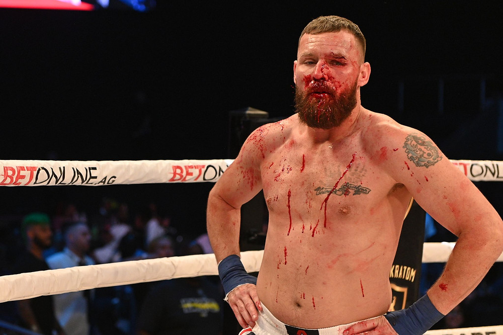 Ryan Jones is cut at BKFC 17 - Photo by Phil Lambert for Bare Knuckle FC