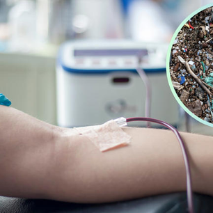 La aféresis puede sacar los microplásticos de la circulación