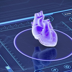 Diagnóstico de amiloidosis cardíaca con IA
