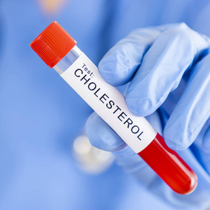 LDL por debajo de 40 mg/dL se asocia a un 25% menos de riesgo de ictus