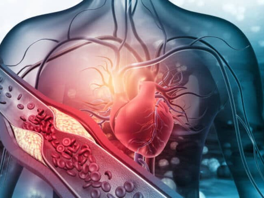 Niveles de LP(a) y riesgo cardiovascular