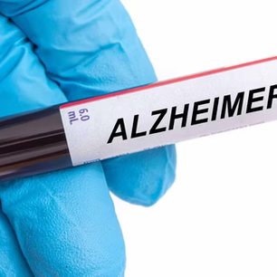 Análisis de sangre para diagnóstico enfermedad de Alzheimer
