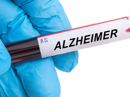 Análisis de sangre para diagnóstico enfermedad de Alzheimer