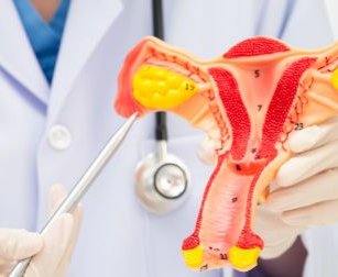 Sangre menstrual para cribado del cáncer de cuello uterino