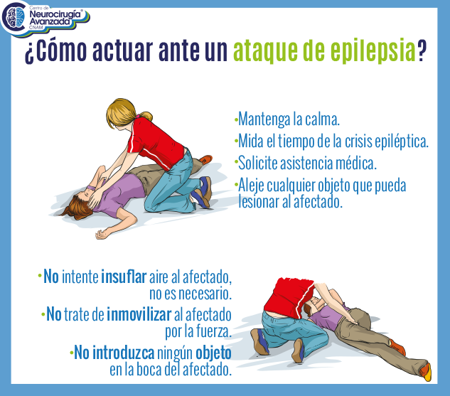 Como actuar ante ataque epilepsia