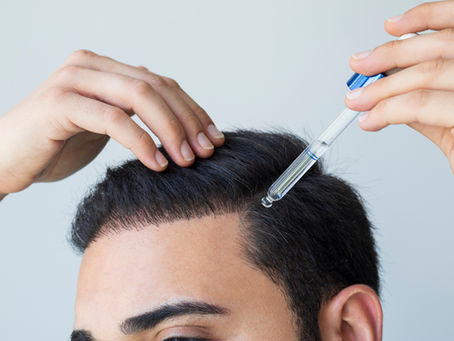 2ddr & hair regrowth