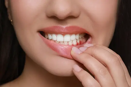 4.2.1_periodontaldisease.webp