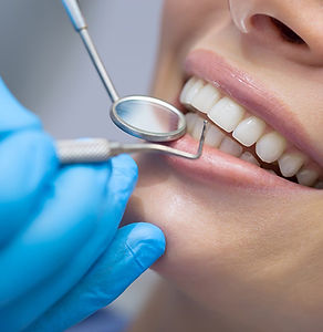 Dental-plaque-on-teeth-Hudsonville-MI-dentists-1200x1031.jpeg