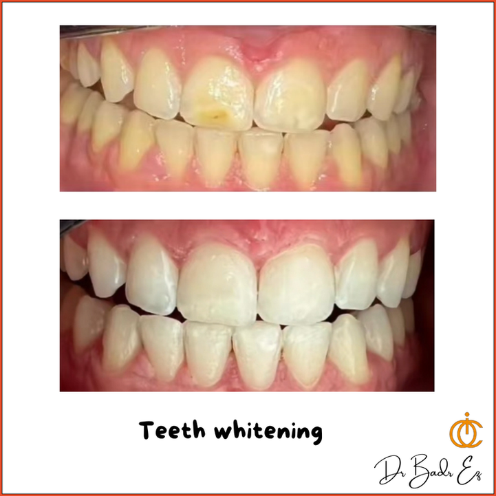 esthétique dentaire rabat