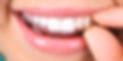 orthodontie.jpg