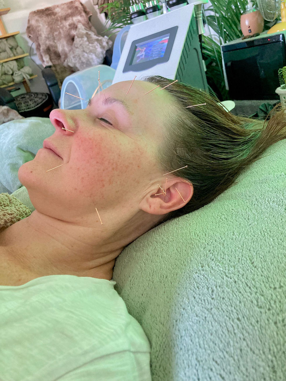 acupuncture Portland Seaweed Spa Dorset