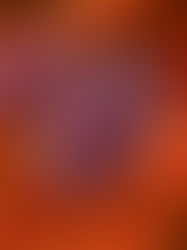 RADAM e a grande virada contra a malária na Amazônia