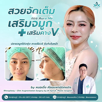 ศัลยกรรมเสริมคาง (Chin Augmentation/Genioplasty) - สร้าง ศัลยกรรมเสริมคาง (Chin Augmentation/Genioplasty) - สร้าง