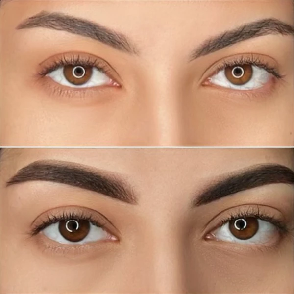 Saline Removal and Correction