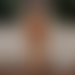 Domande frequenti sull’epilazione definitiva laser