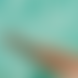 Cosa non fare prima del laser?