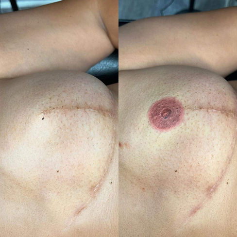 areola.jpg