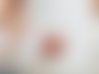 implante dentario em interlagos são paulo