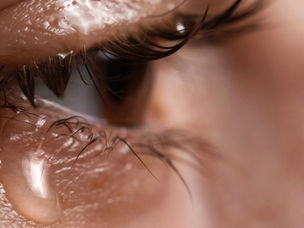 Lacrimejamento excessivo, quando investigar as vias lacrimais?