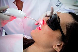 Laserterapia na Odontologia: como o dentista usa o laser para reduzir dor e acelerar a cicatrização