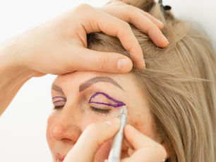 Quando a blefaroplastia é realmente indicada por um oftalmologista?