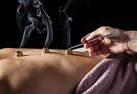 moxibustion-cones-moxa-treatment-points-top-needles.webp