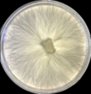 Agar Plate Transfers