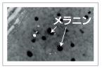 白髪に関わる２つのＤＮＡ