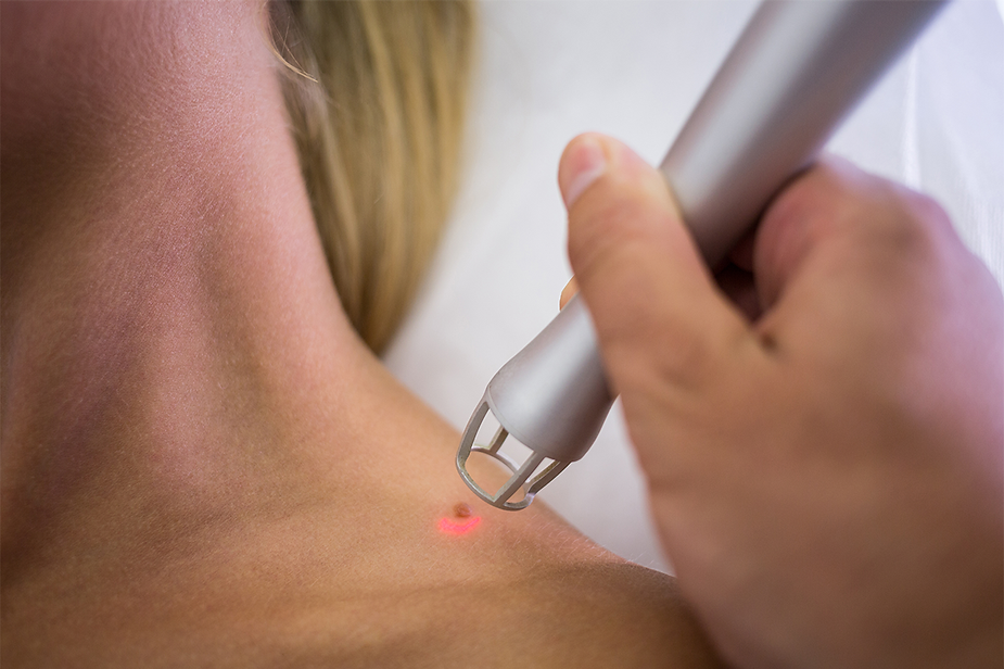 Laser Healing: Unlocking the Healing Power of Light