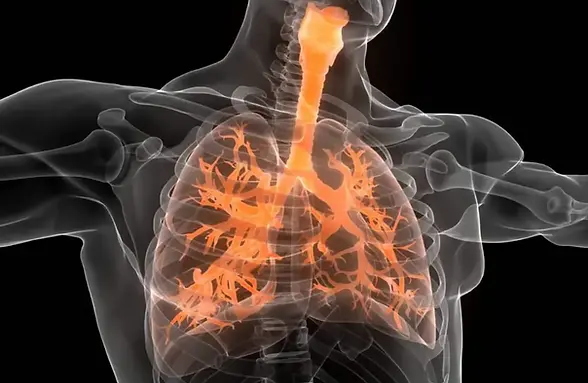 ozone burn lung.webp