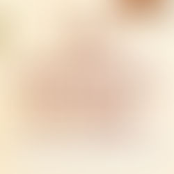 Las aventuras de Nuez