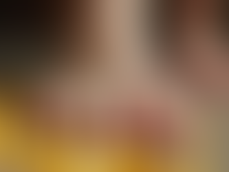 Effective Tips for Treating Corns at Home: Home Remedies for Corns