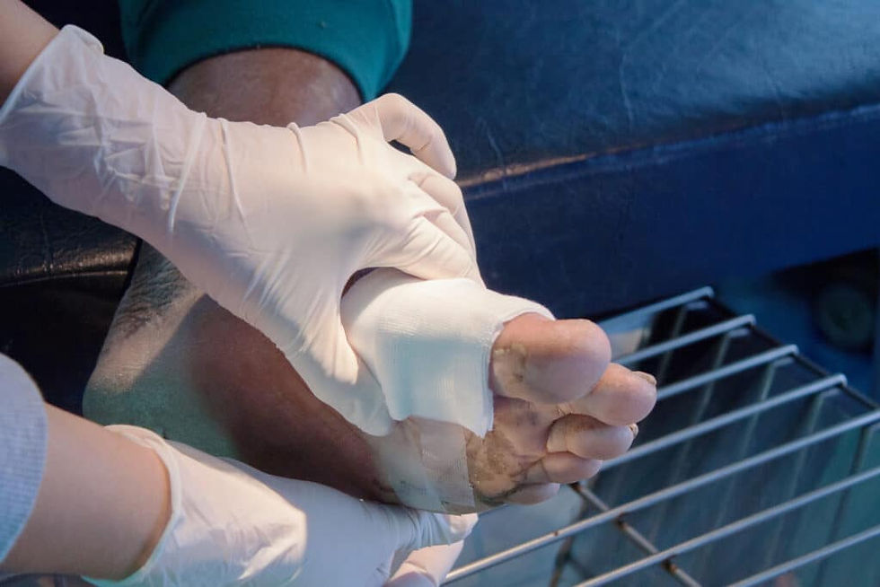 Dr. R. Scott Johnston DPM treating diabetic foot wound in Perrysburg Ohio