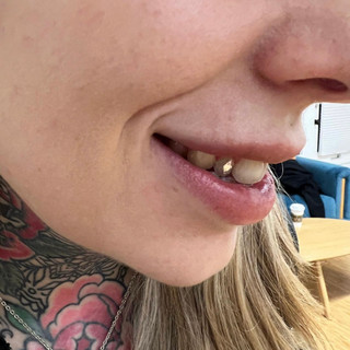 toothgem.jpeg
