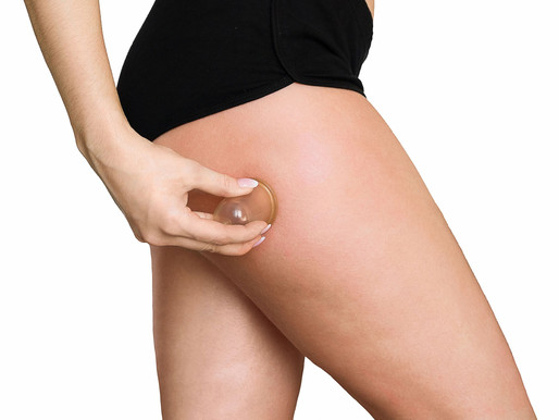 Cellulite Cupping