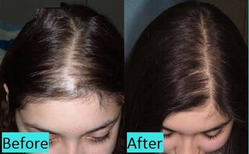 Female after 6 sessions.jpeg