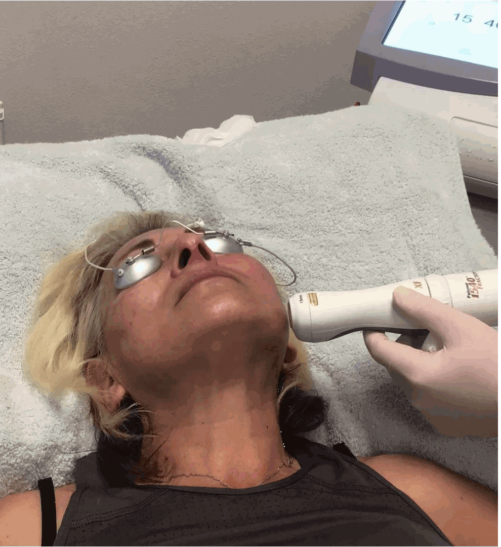 Three for me laser treatment in Las Vegas