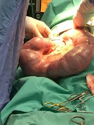 pyometra in dog, large pyometra, pyometra surgery