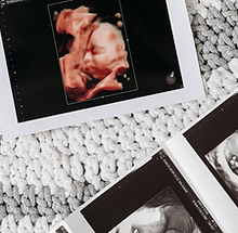 Prenatal youtube image.png